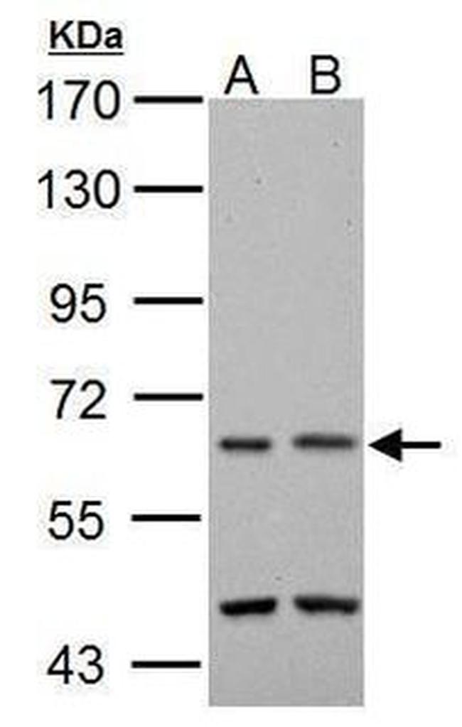 TAK1 Antibody in Western Blot (WB)