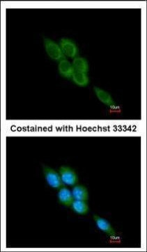Mu-Calpain Antibody in Immunocytochemistry (ICC/IF)