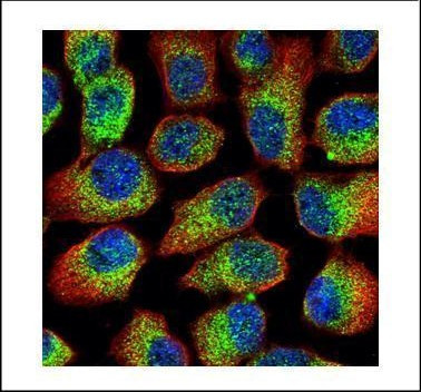 Mu-Calpain Antibody in Immunocytochemistry (ICC/IF)