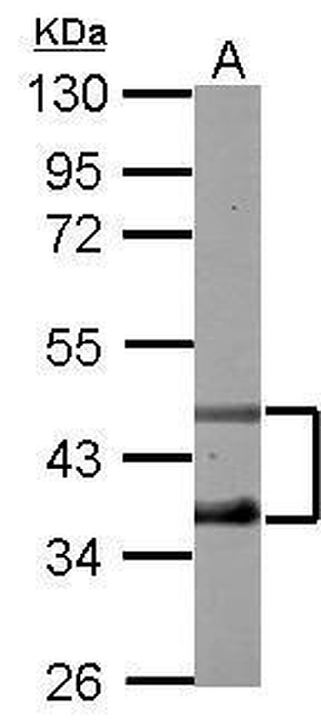 DP2 Antibody in Western Blot (WB)