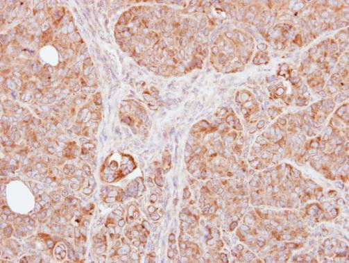 TRAF1 Antibody in Immunohistochemistry (Paraffin) (IHC (P))
