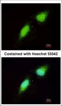 NADE Antibody in Immunocytochemistry (ICC/IF)