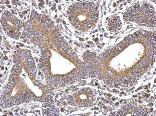 SERCA3 ATPase Antibody in Immunohistochemistry (Paraffin) (IHC (P))