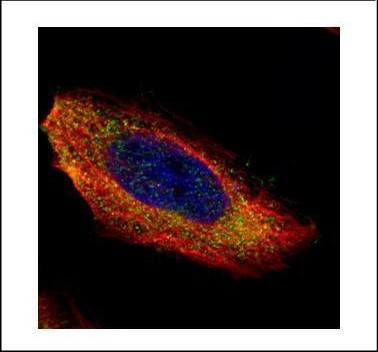 MEK1 Antibody in Immunocytochemistry (ICC/IF)