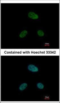 DRAK1 Antibody in Immunocytochemistry (ICC/IF)