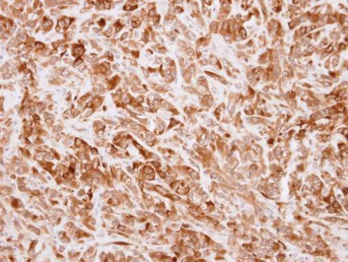 TRIP Antibody in Immunohistochemistry (Paraffin) (IHC (P))