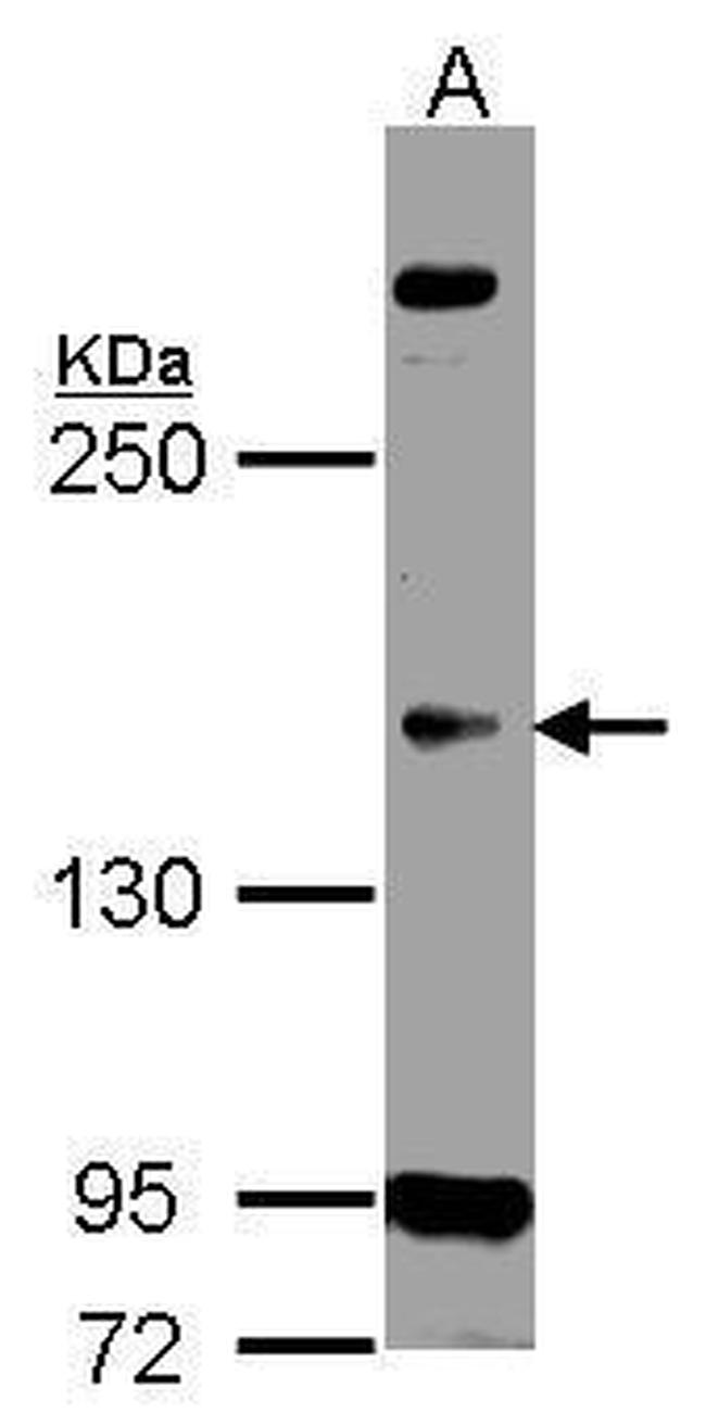 CDK13 Antibody in Western Blot (WB)