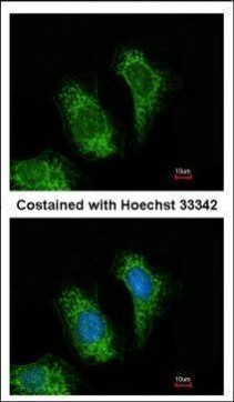 TRAF5 Antibody in Immunocytochemistry (ICC/IF)