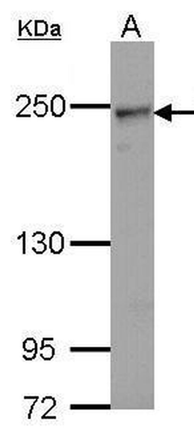 COL4A2 Antibody in Western Blot (WB)