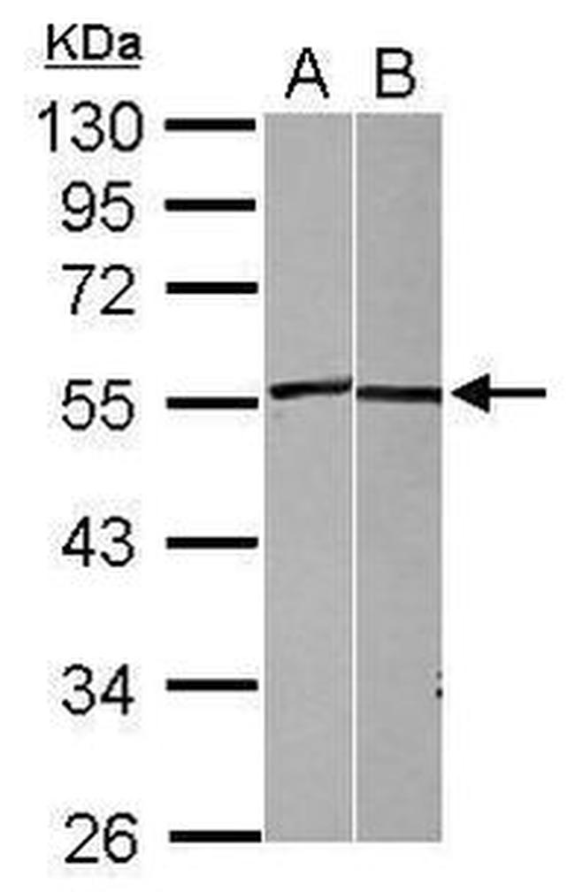 CD262 (DR5) Antibody in Western Blot (WB)