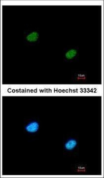 RBBP5 Antibody in Immunocytochemistry (ICC/IF)
