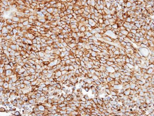 GRK3 Antibody in Immunohistochemistry (Paraffin) (IHC (P))