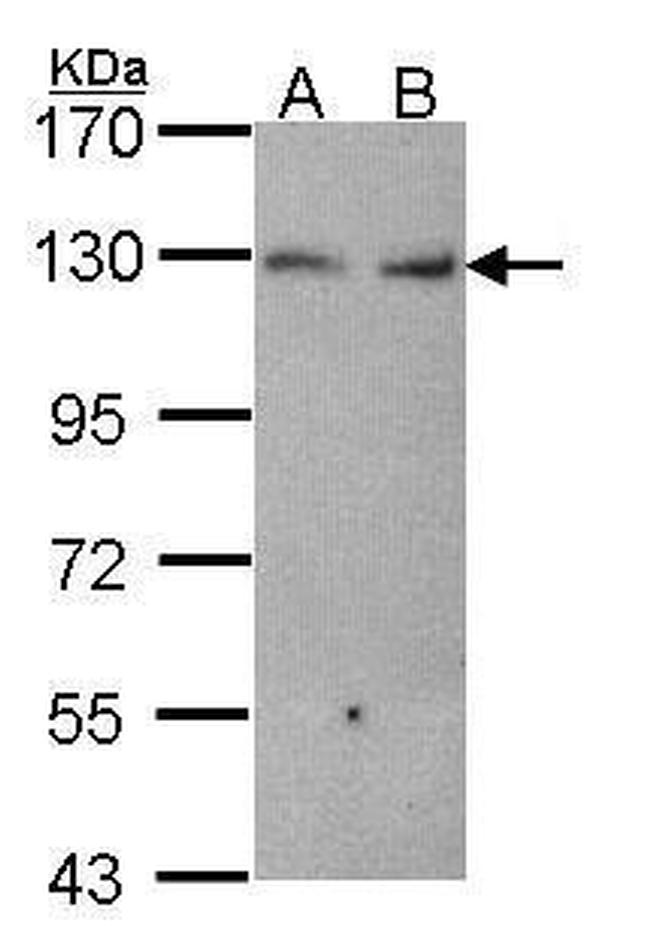 K-cadherin Antibody in Western Blot (WB)
