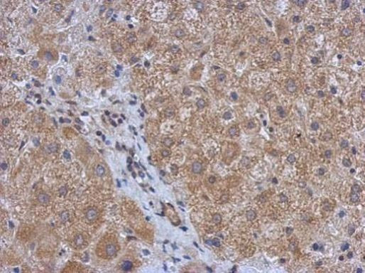 DDR2 Antibody in Immunohistochemistry (Paraffin) (IHC (P))