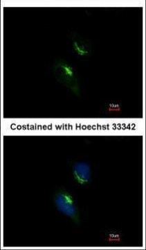PRPS1 Antibody in Immunocytochemistry (ICC/IF)