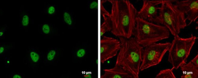 GABPA Antibody in Immunocytochemistry (ICC/IF)
