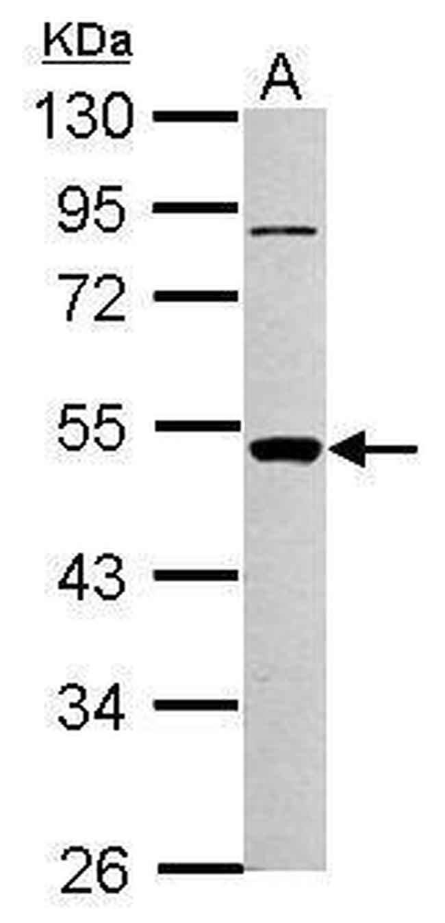 PIGA Antibody in Western Blot (WB)