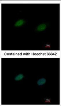 UBA2 Antibody in Immunocytochemistry (ICC/IF)