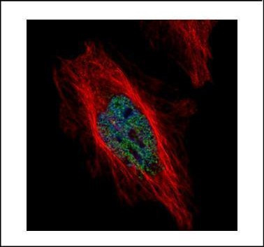 DYRK1B Antibody in Immunocytochemistry (ICC/IF)