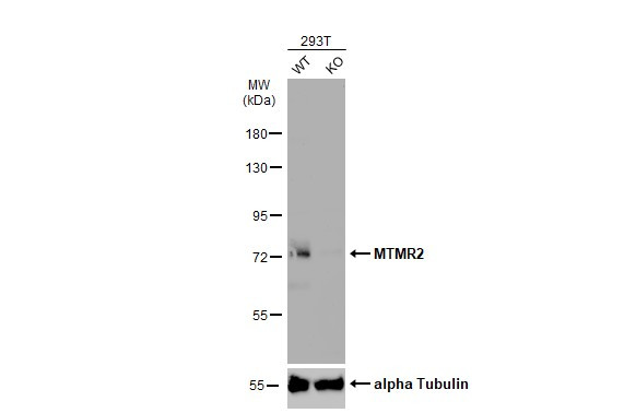 MTMR2 Antibody in Western Blot (WB)