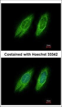 GBF1 Antibody in Immunocytochemistry (ICC/IF)
