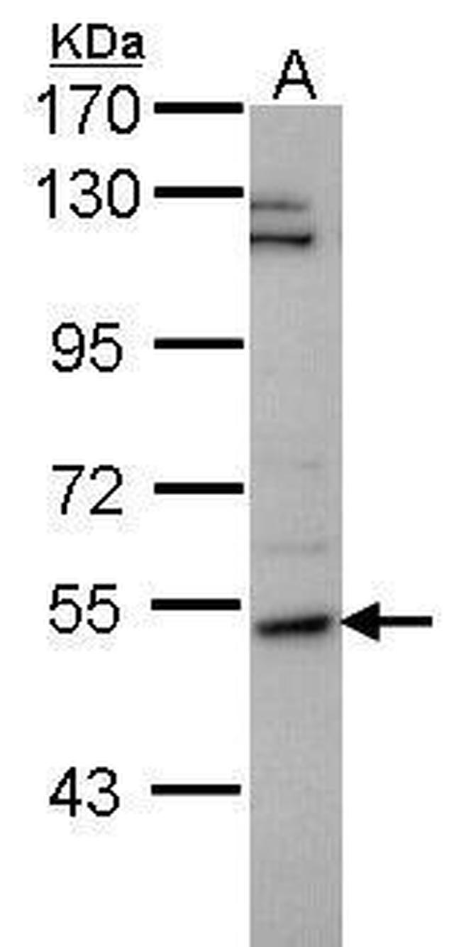 P4HA2 Antibody in Western Blot (WB)
