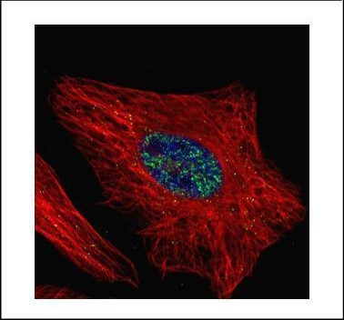 WTAP Antibody in Immunocytochemistry (ICC/IF)