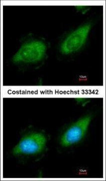 TPL2 Antibody in Immunocytochemistry (ICC/IF)