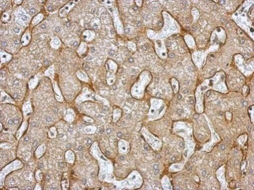 TNFR1 Antibody in Immunohistochemistry (Paraffin) (IHC (P))