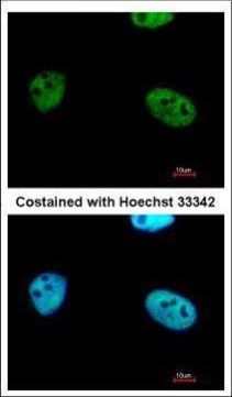 WTAP Antibody in Immunocytochemistry (ICC/IF)
