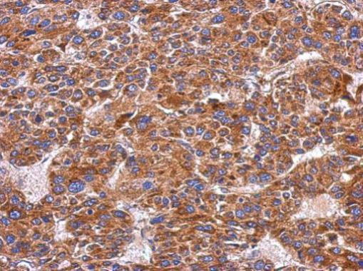 ITGA9 Antibody in Immunohistochemistry (Paraffin) (IHC (P))