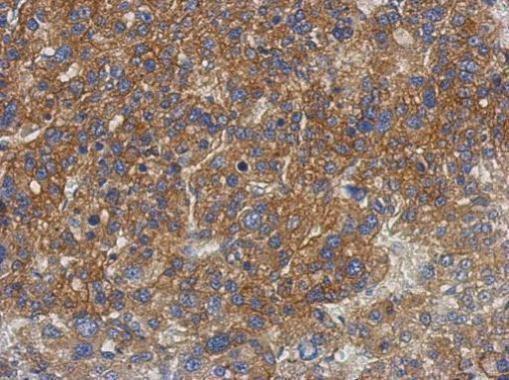 GS2 Antibody in Immunohistochemistry (Paraffin) (IHC (P))