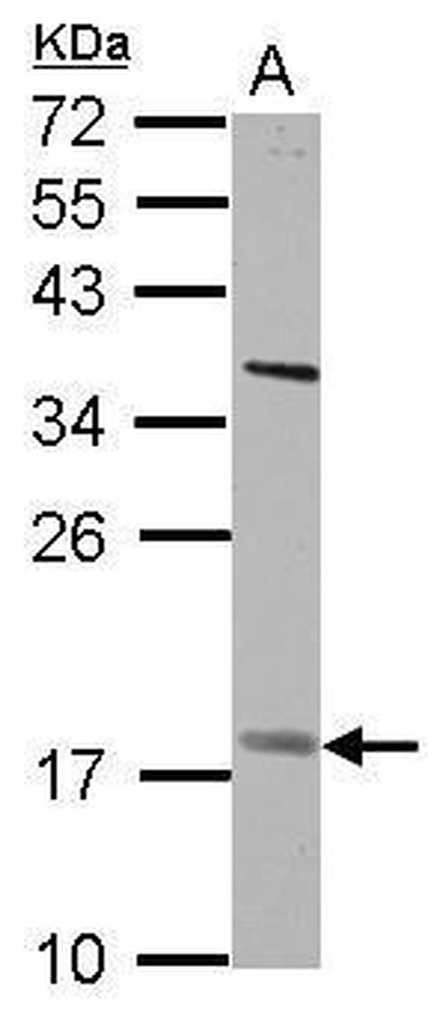 GS2 Antibody in Western Blot (WB)