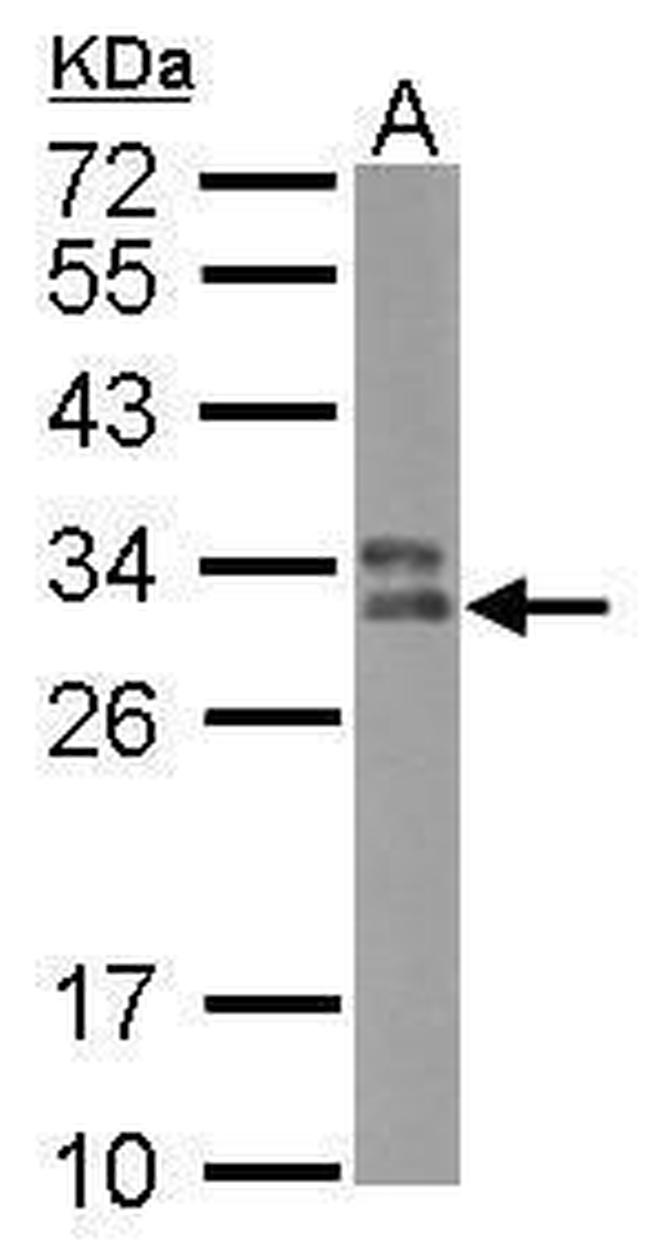 HLA-DPB1 Antibody in Western Blot (WB)