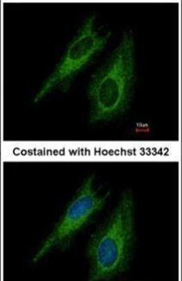 TGFBR1 Antibody in Immunocytochemistry (ICC/IF)