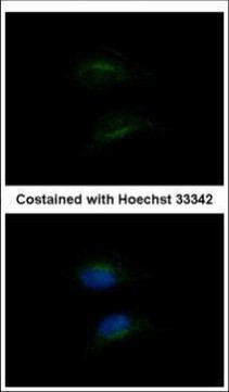 HSD3B2 Antibody in Immunocytochemistry (ICC/IF)