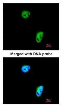 TLK1 Antibody in Immunocytochemistry (ICC/IF)