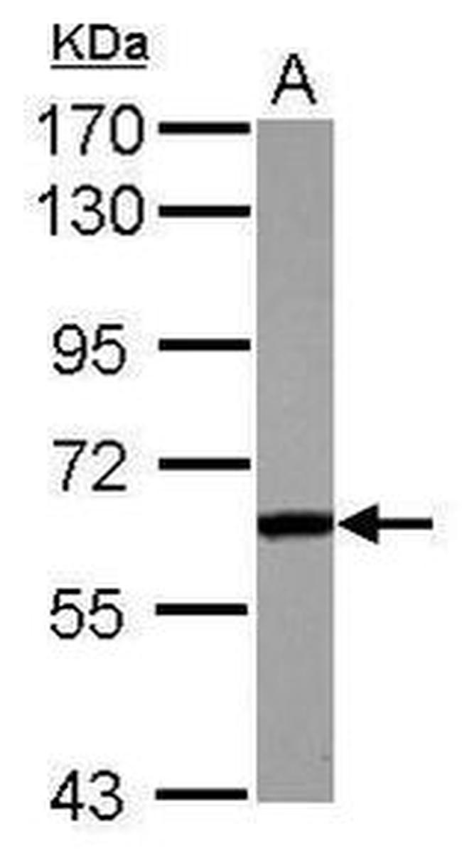 FGR Antibody in Western Blot (WB)