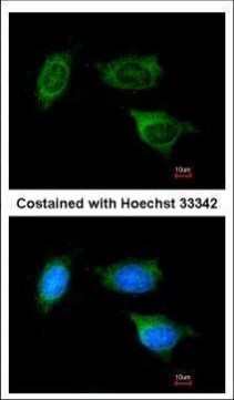 ATP Synthase B1 Antibody in Immunocytochemistry (ICC/IF)