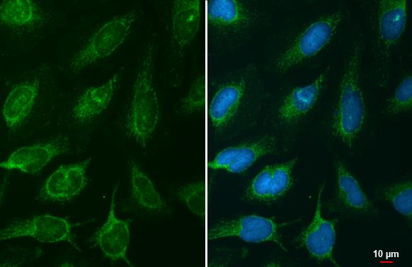 NNT Antibody in Immunocytochemistry (ICC/IF)