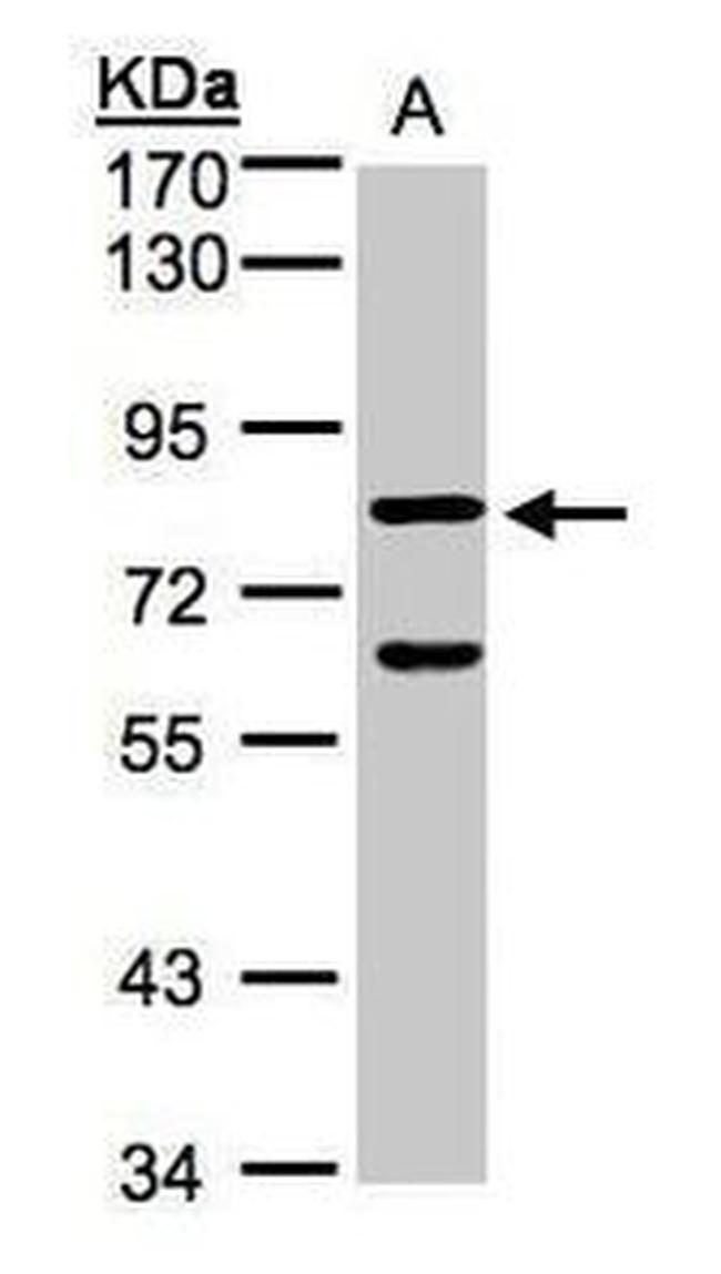 Cyclin F Antibody in Western Blot (WB)