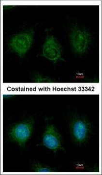 DAK Antibody in Immunocytochemistry (ICC/IF)