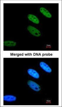 TAF15 Antibody in Immunocytochemistry (ICC/IF)