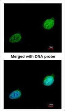 XPA Antibody in Immunocytochemistry (ICC/IF)
