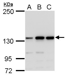 MSH3 Antibody in Western Blot (WB)