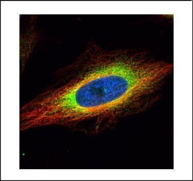 GRP94 Antibody in Immunocytochemistry (ICC/IF)