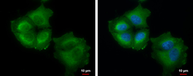 Thymidylate Synthase Antibody in Immunocytochemistry (ICC/IF)