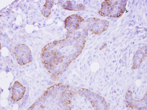 FRS2 Antibody in Immunohistochemistry (Paraffin) (IHC (P))