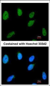 RAD54B Antibody in Immunocytochemistry (ICC/IF)