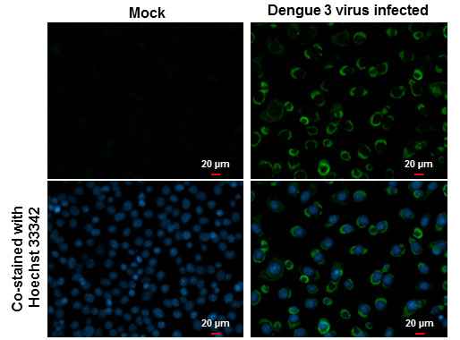 Dengue Virus Type 2 NS4B Antibody in Immunocytochemistry (ICC/IF)